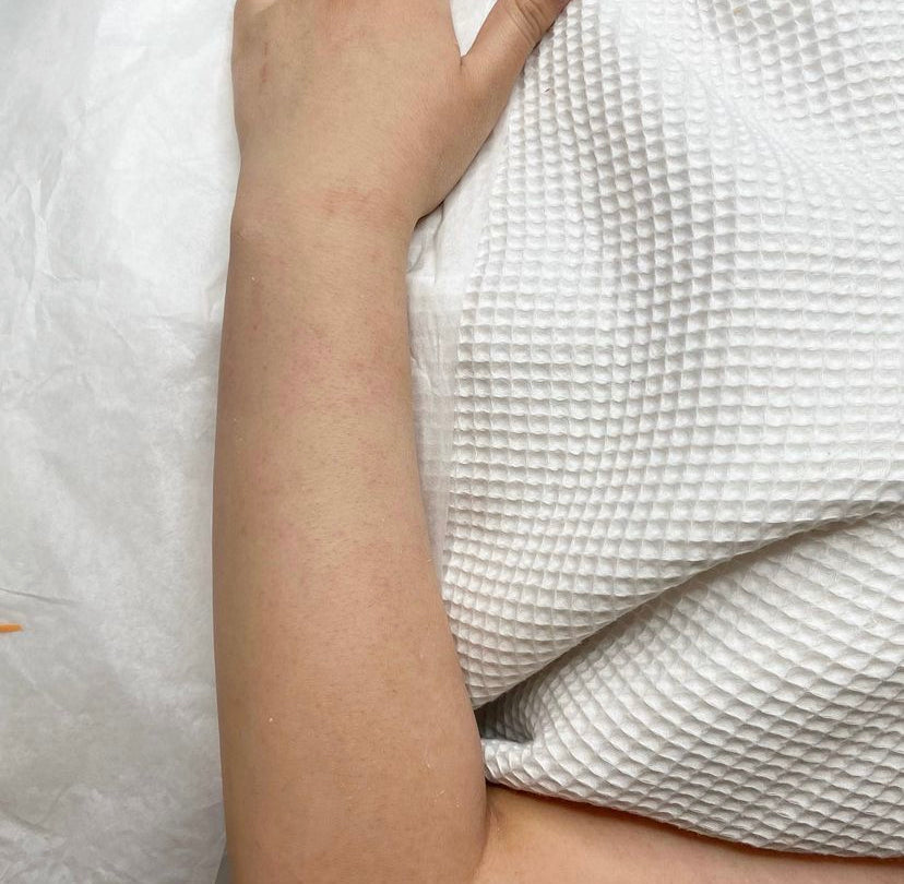 Cera de medio brazo