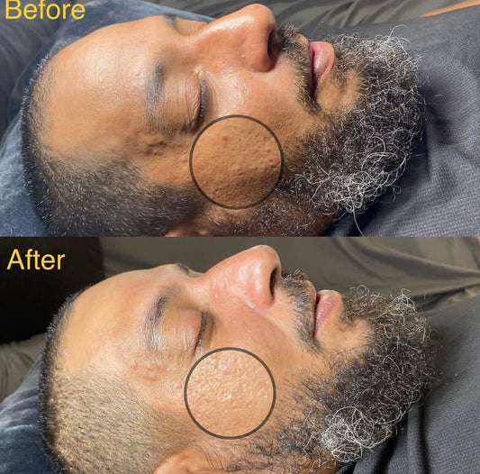 Gentlemen Facial