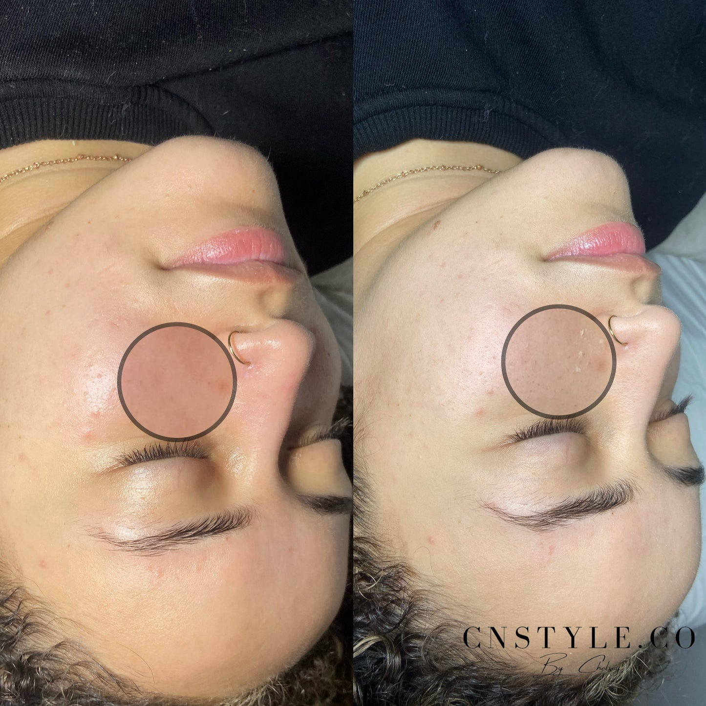 First Time Signature Facial